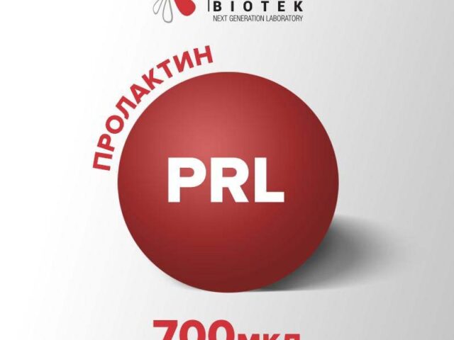 Испитување за Пролактин