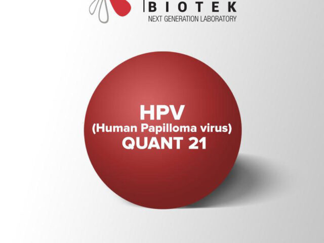 Молекуларен тест за детекција, генотипизација и квантификација на 21 високо и ниско ризични типови на HPV (Human Papilloma virus) QUANT 21 со Multipex Real Time PCR метод