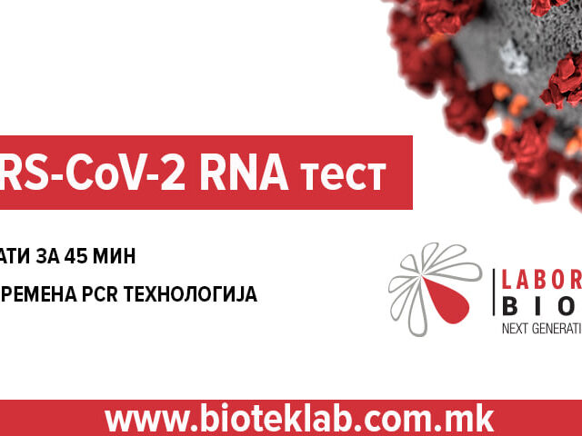 Новитет во Биотек Лабораторија